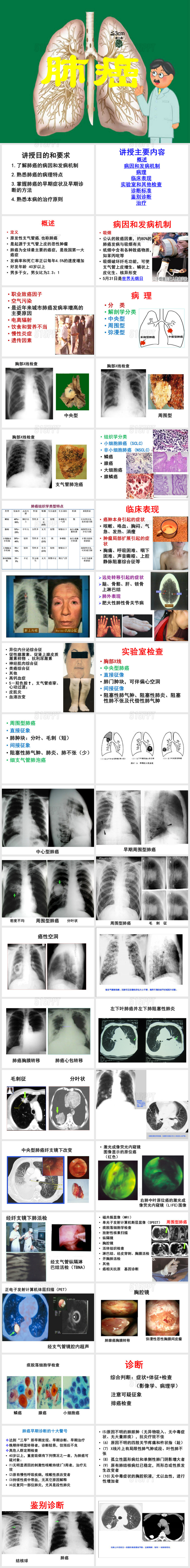 肺癌的诊断与治疗PPT模板