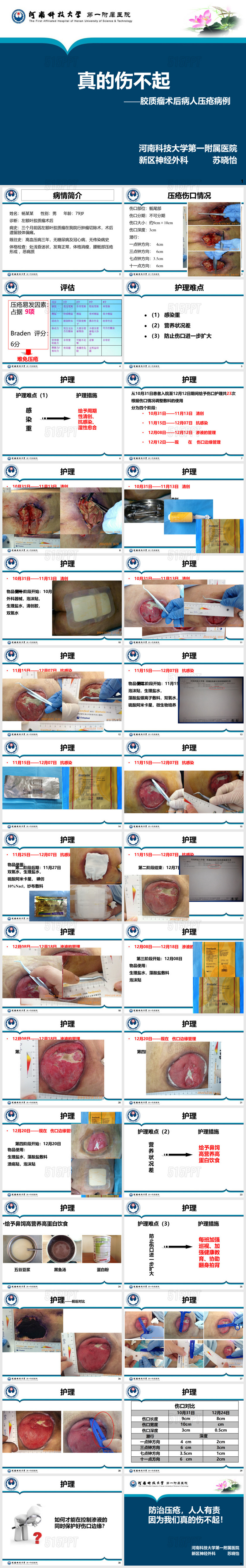 压疮患者护理查房ppt模板